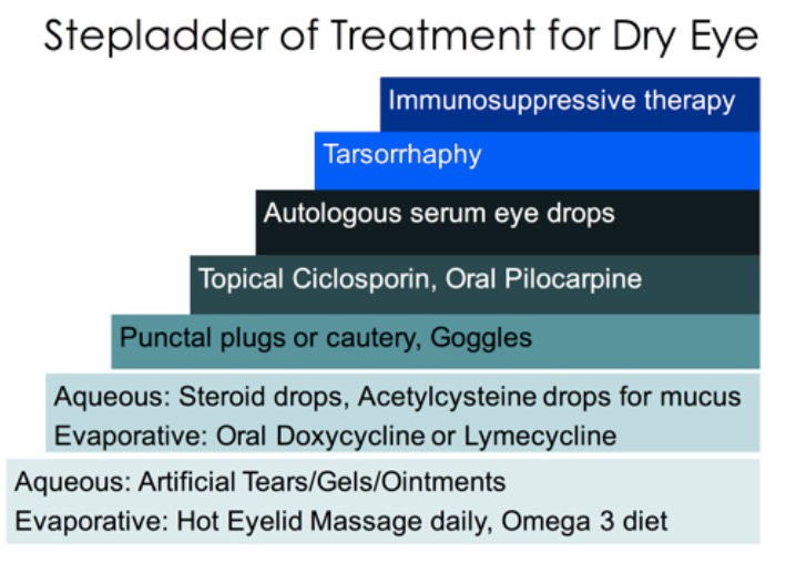 treatment-for-dry-eye
