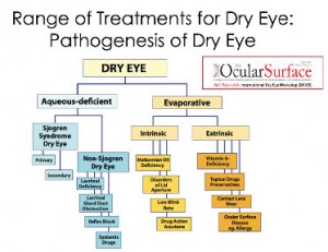 range of treatments for dry eye