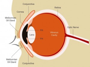 cataract diagram